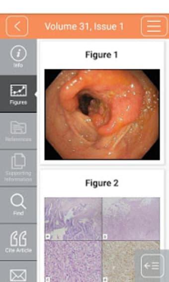 Jnl Gastroenterology & Hepatol2