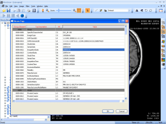 MicroDicom Viewer Autorun1