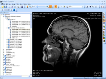 MicroDicom Viewer Portable1