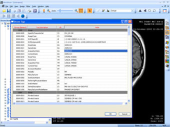 MicroDicom1