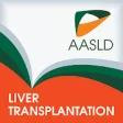 Liver Transplantation