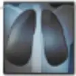 MicroDicom Viewer Autorun